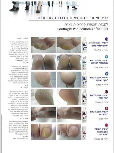125ML קרם מוס Footlogix